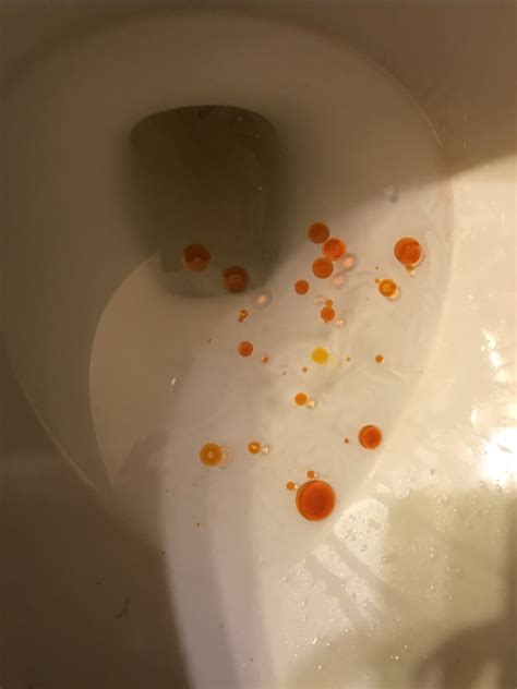 Orlistat orange oil poop. Things To Know About Orlistat orange oil poop. 